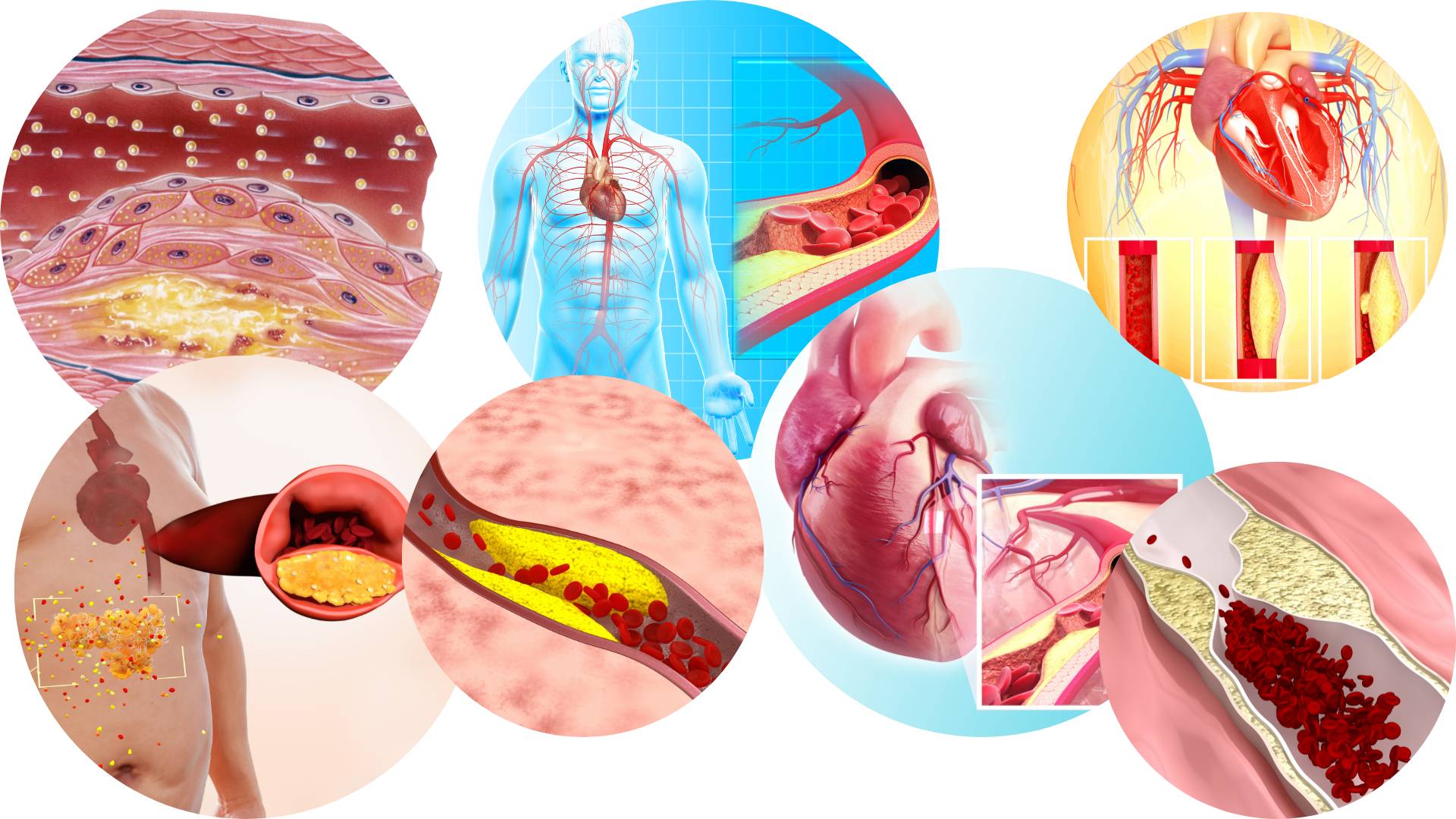 Course: Adult Cardiovascular Disease Prevention